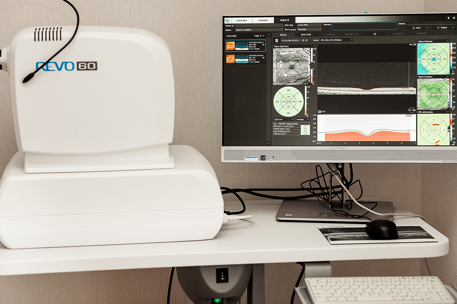 Оптический томограф с функцией ангиографии
